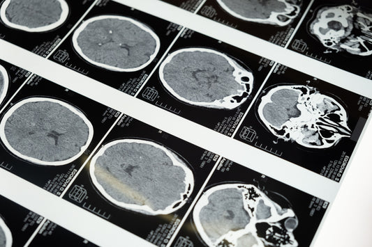 Coffee and Long-Term Brain Health: What the 2026 Research Actually Shows About Cognitive Decline
